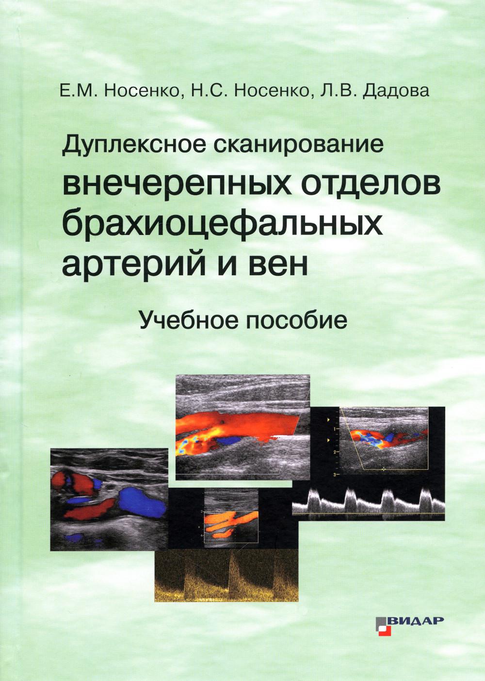 

Дуплексное сканирование внечерепных отделов брахиоцефальных артерий и вен