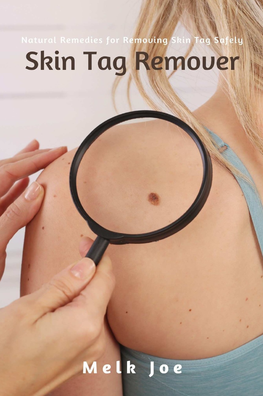 

Skin Tag Remover