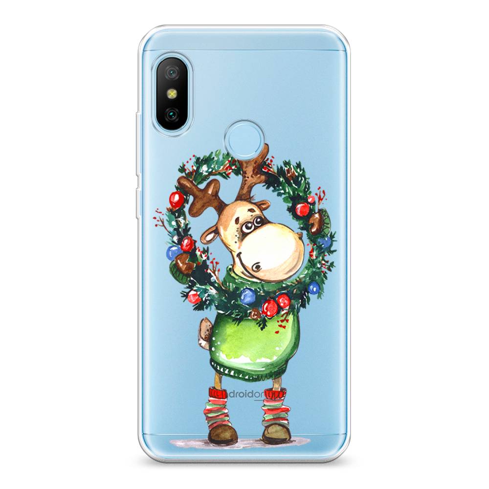 

Чехол на Xiaomi Poco M4 Pro 5G/Redmi Note 11S 5G "Хаски 2", 34250-4
