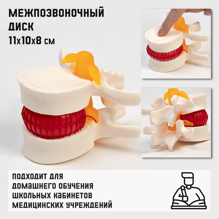 

Макет Межпозвоночный диск 11x10x8см