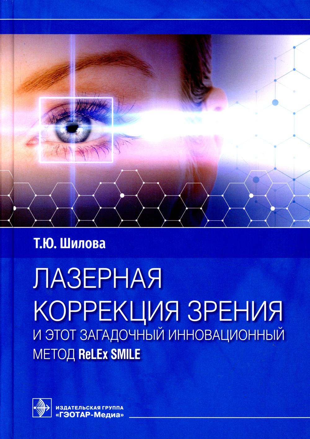 

Лазерная коррекция зрения и этот загадочный инновационный метод ReLEx SMILE