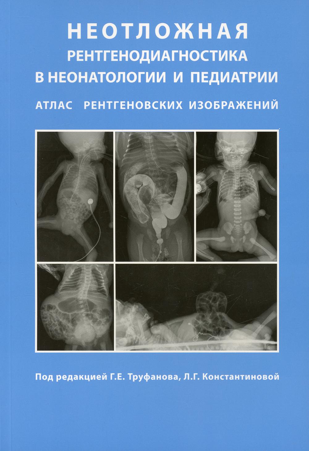 фото Книга неотложная рентгенодиагностика в неонатологии и педиатрии элби