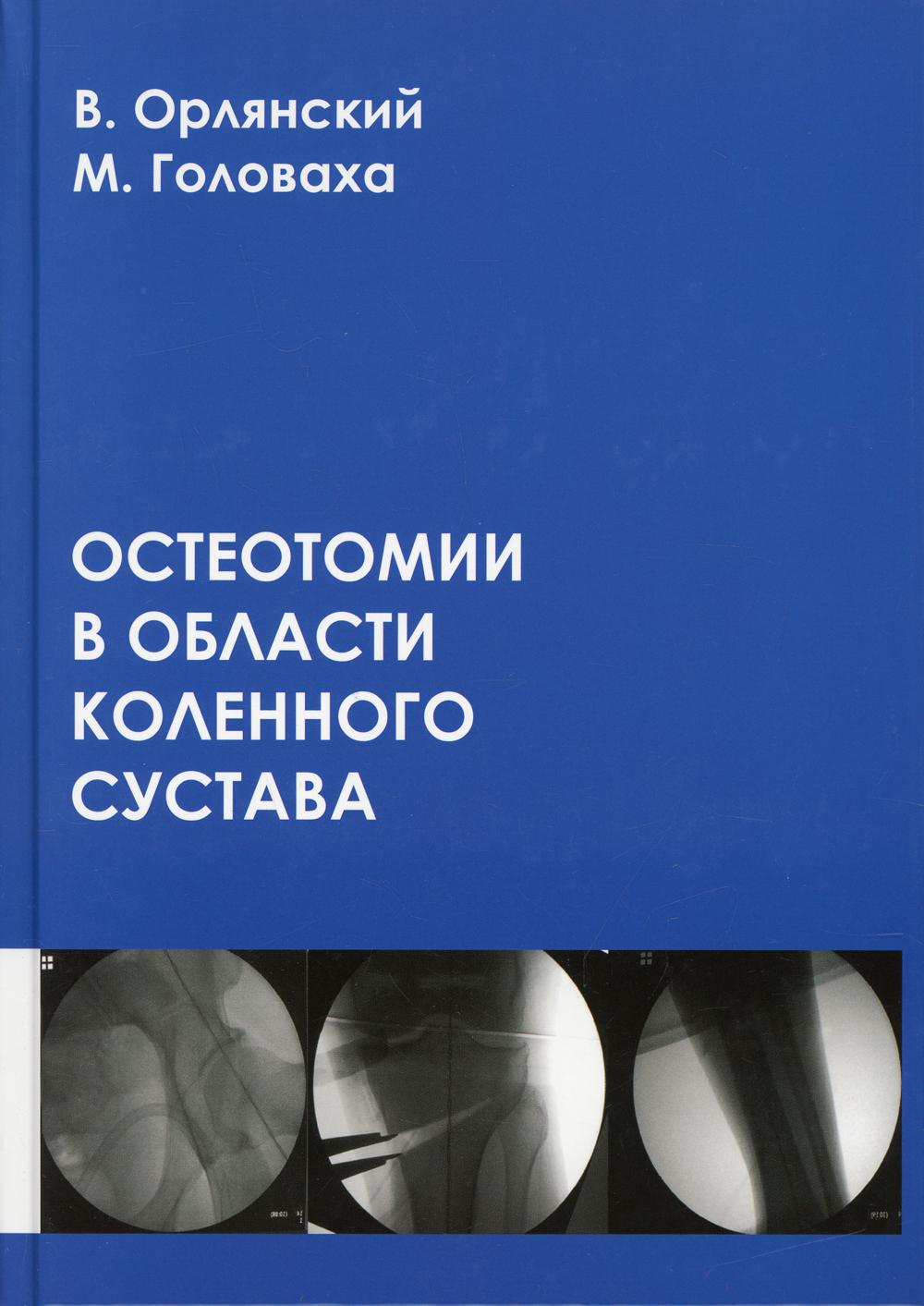 фото Книга остеотомии в области коленного сустава спецлит