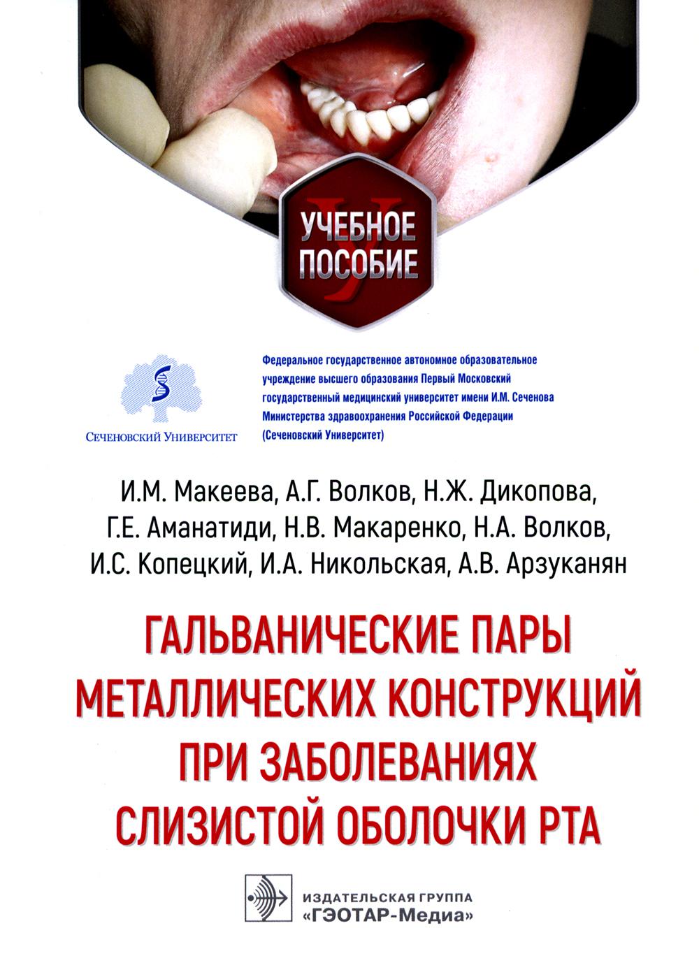 

Гальванические пары металлических конструкций при заболеваниях слизистой…