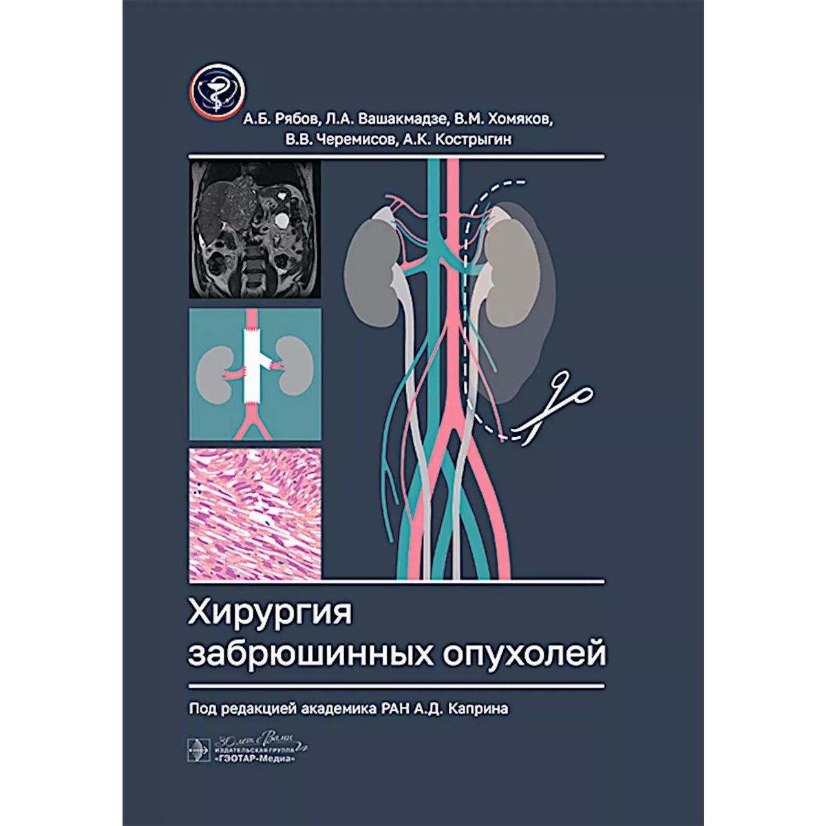 

Хирургия забрюшинных опухолей, образование и наука