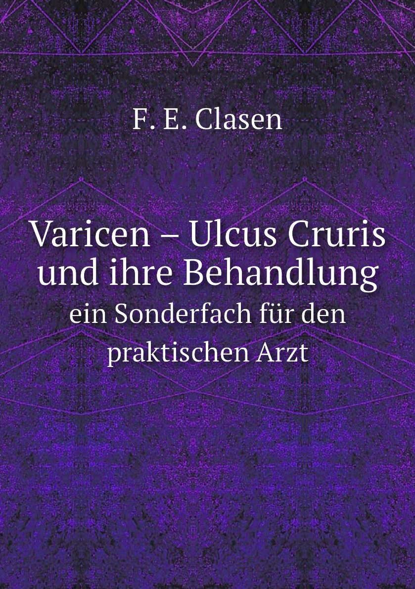 

Varicen – Ulcus Cruris und ihre Behandlung