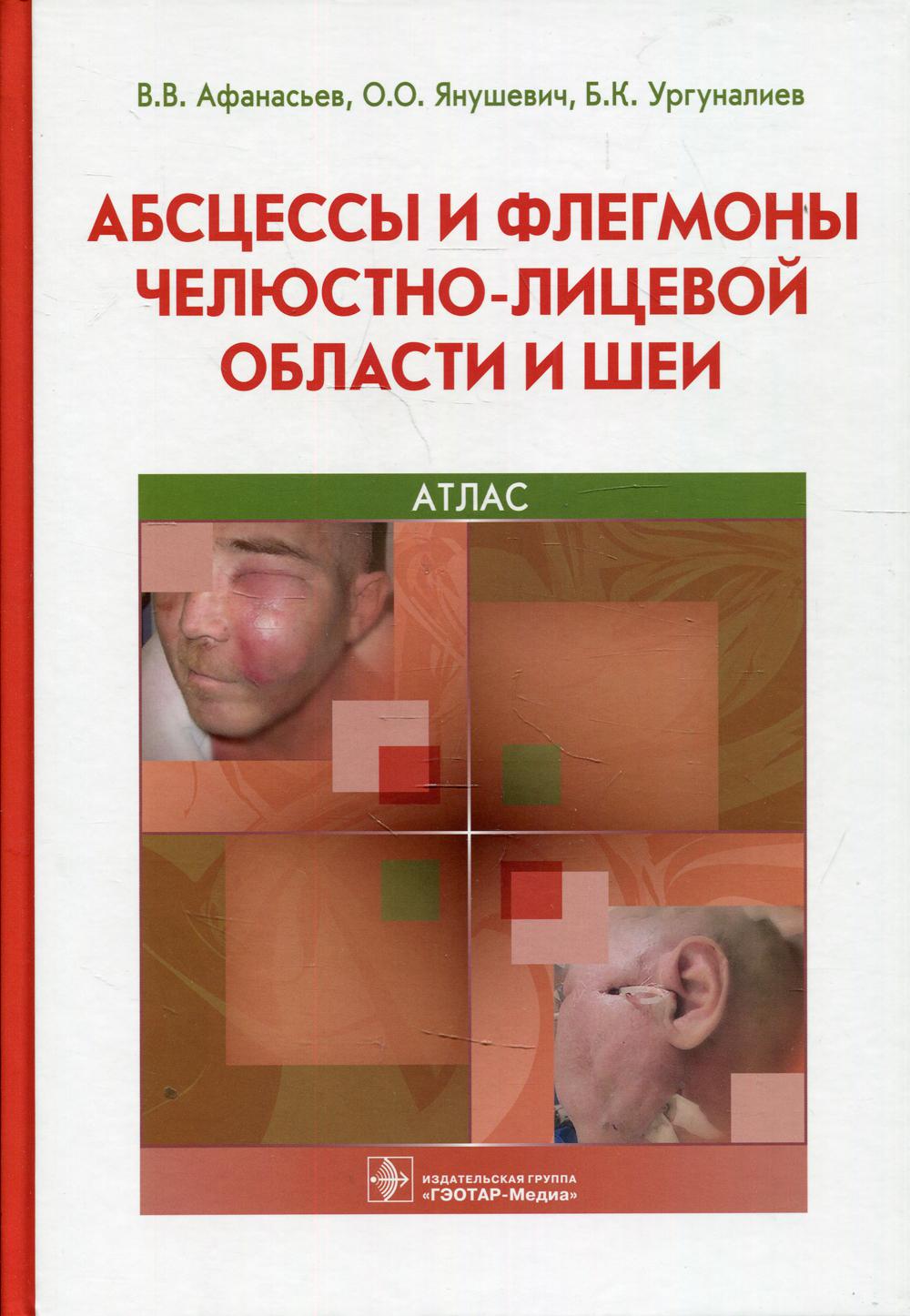 

Абсцессы и флегмоны челюстно-лицевой области и шеи