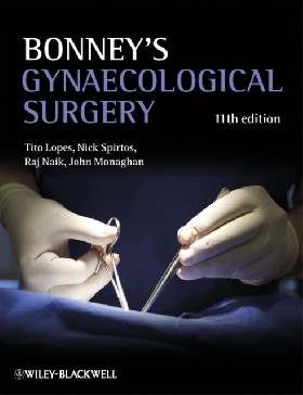 

Bonney’s Gynaecological Surgery / Lopes