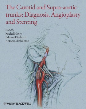 

The Carotid and Supra-Aortic Trunks: Diagnosis, Angioplasty and Stenting, 2nd Edition