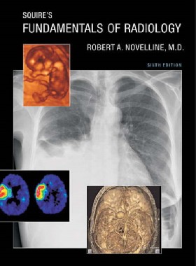 

Squire`s fundamentals of radiology, 6 ed. / Novelline, Robert A.