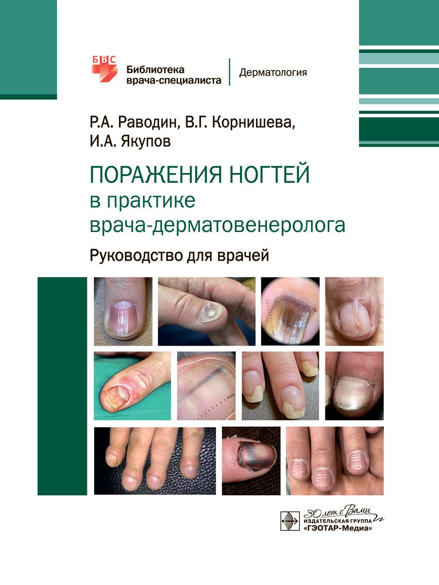 

Поражения ногтей в практике врача-дерматовенеролога: руководство для врачей