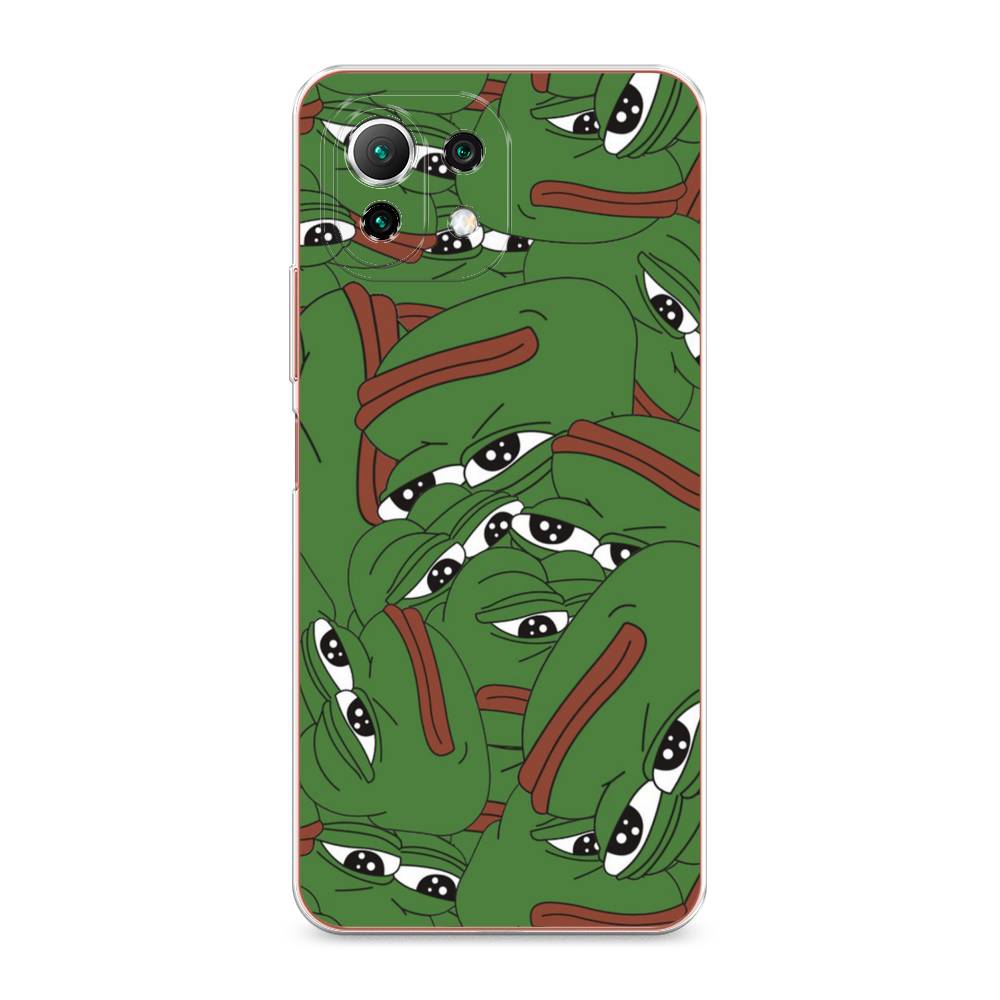 

Чехол Awog на Xiaomi Mi 11 Lite/5G NE "Печальный frog", Разноцветный, 310250-9