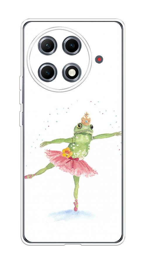 

Чехол на Tecno Camon 30S Pro Лягушка-балерина, Зеленый, 309550-1