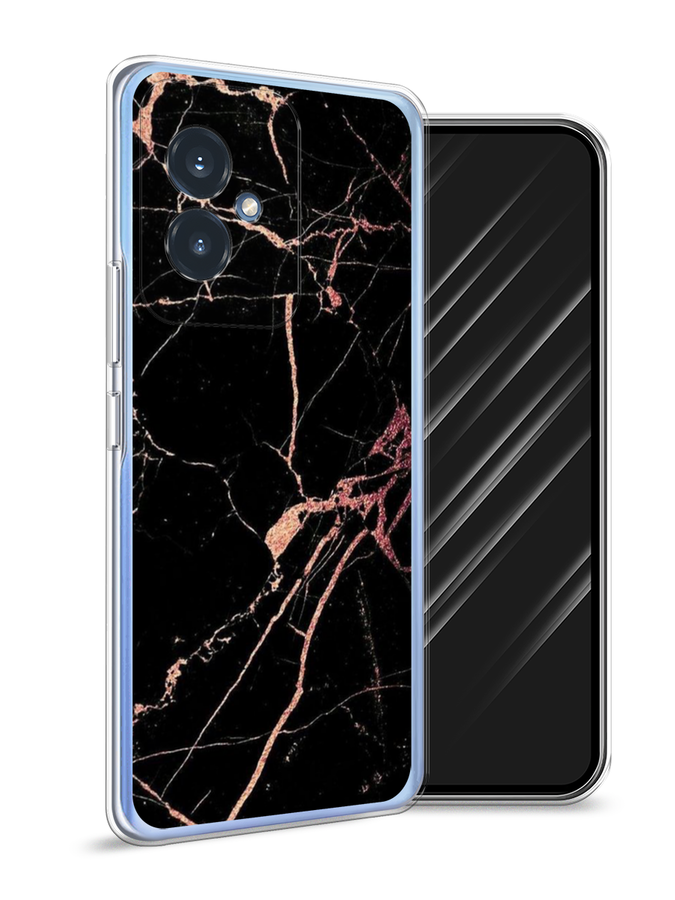 

Чехол Awog на Honor 100 "Мрамор розовое золото", Черный;розовый, 6122750-1
