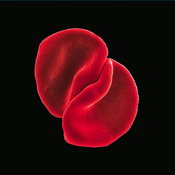 Peter Gabriel: Scratch My Back (2 CD)