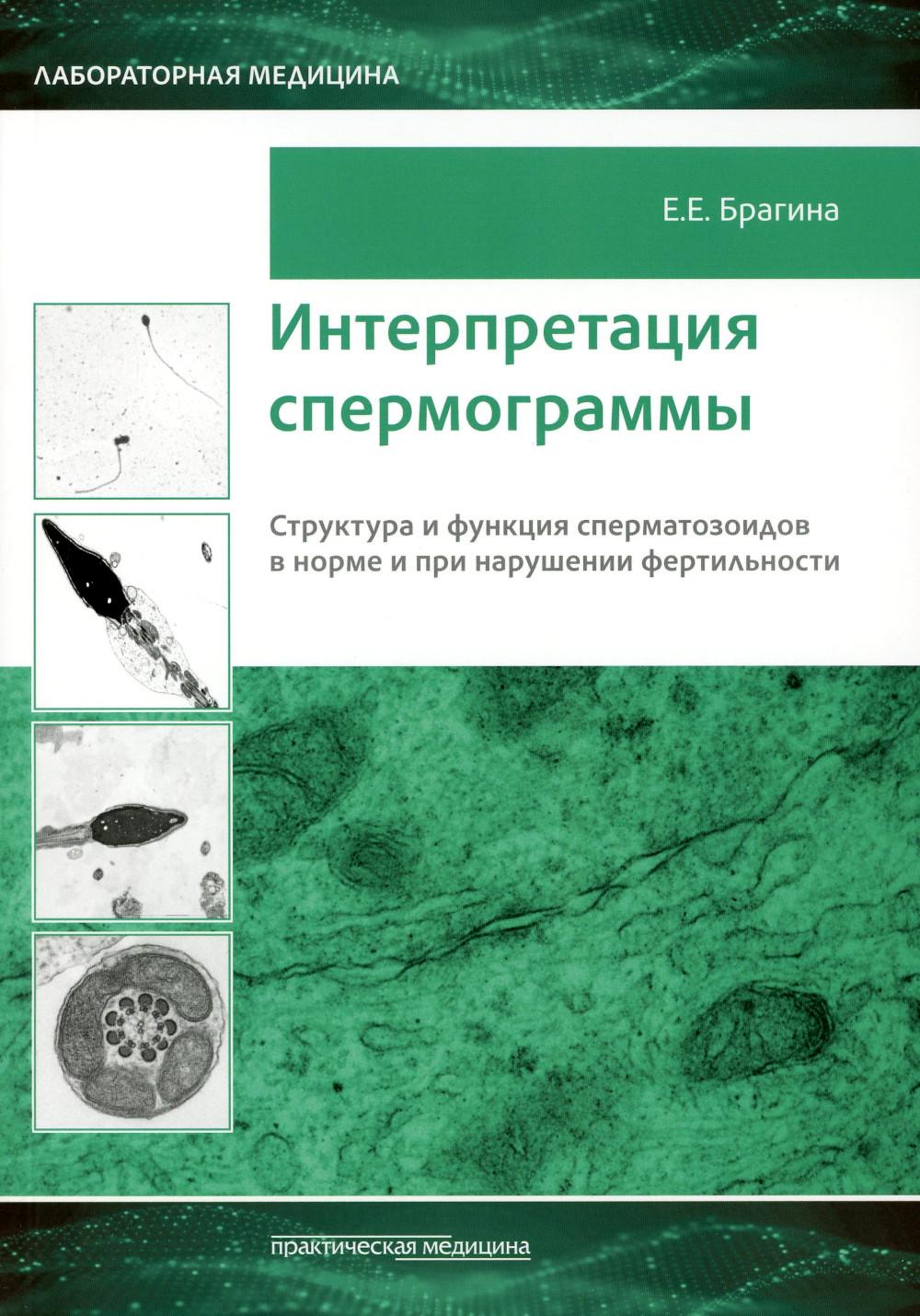 

Интерпретация спермограммы: структура и функция сперматозоидов в норме и при наруш.