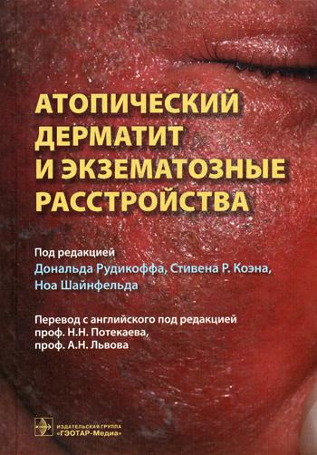 фото Книга атопический дерматит и экзематозные расстройства гэотар-медиа