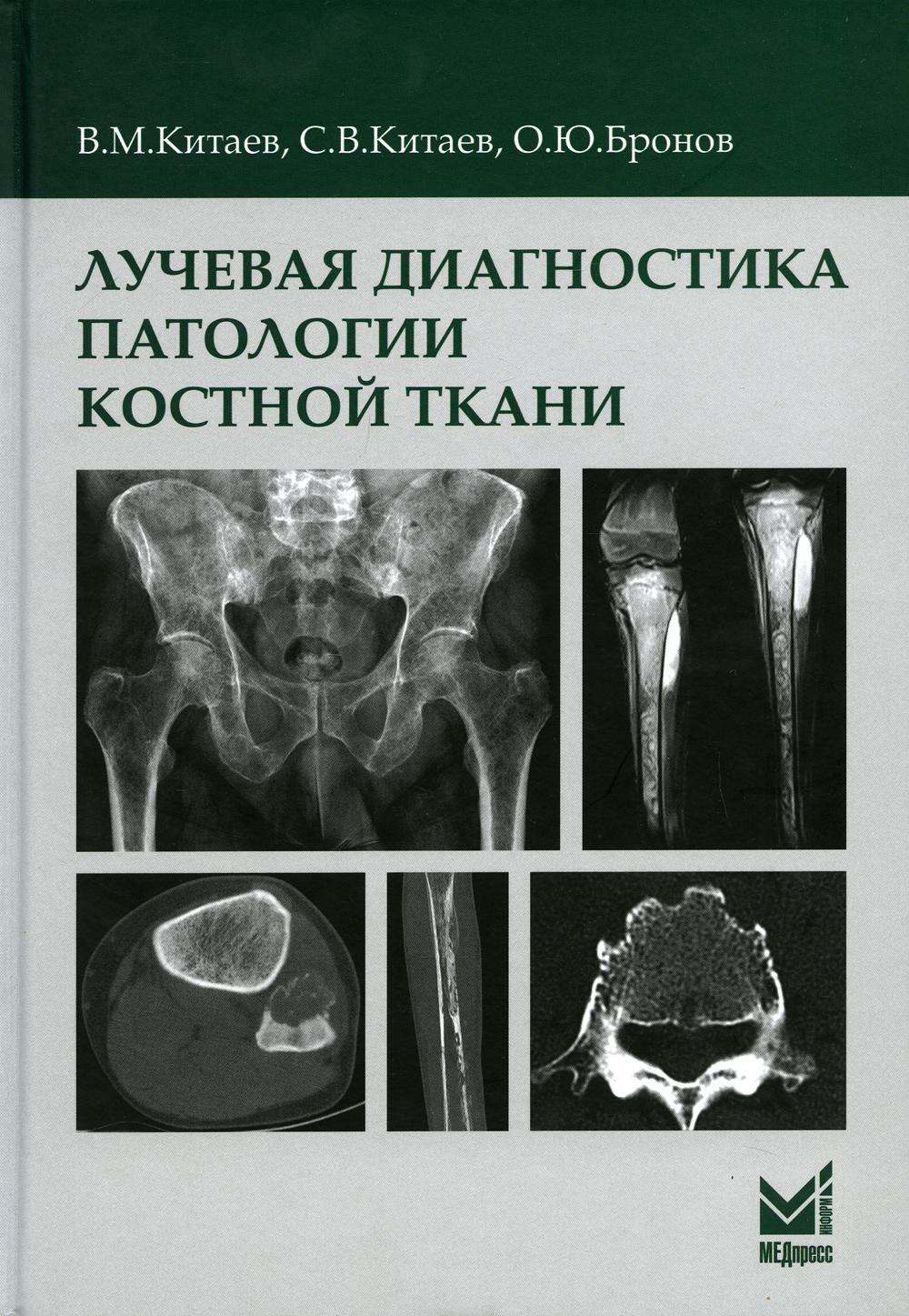 фото Книга лучевая диагностика патологии костной ткани медпресс-информ