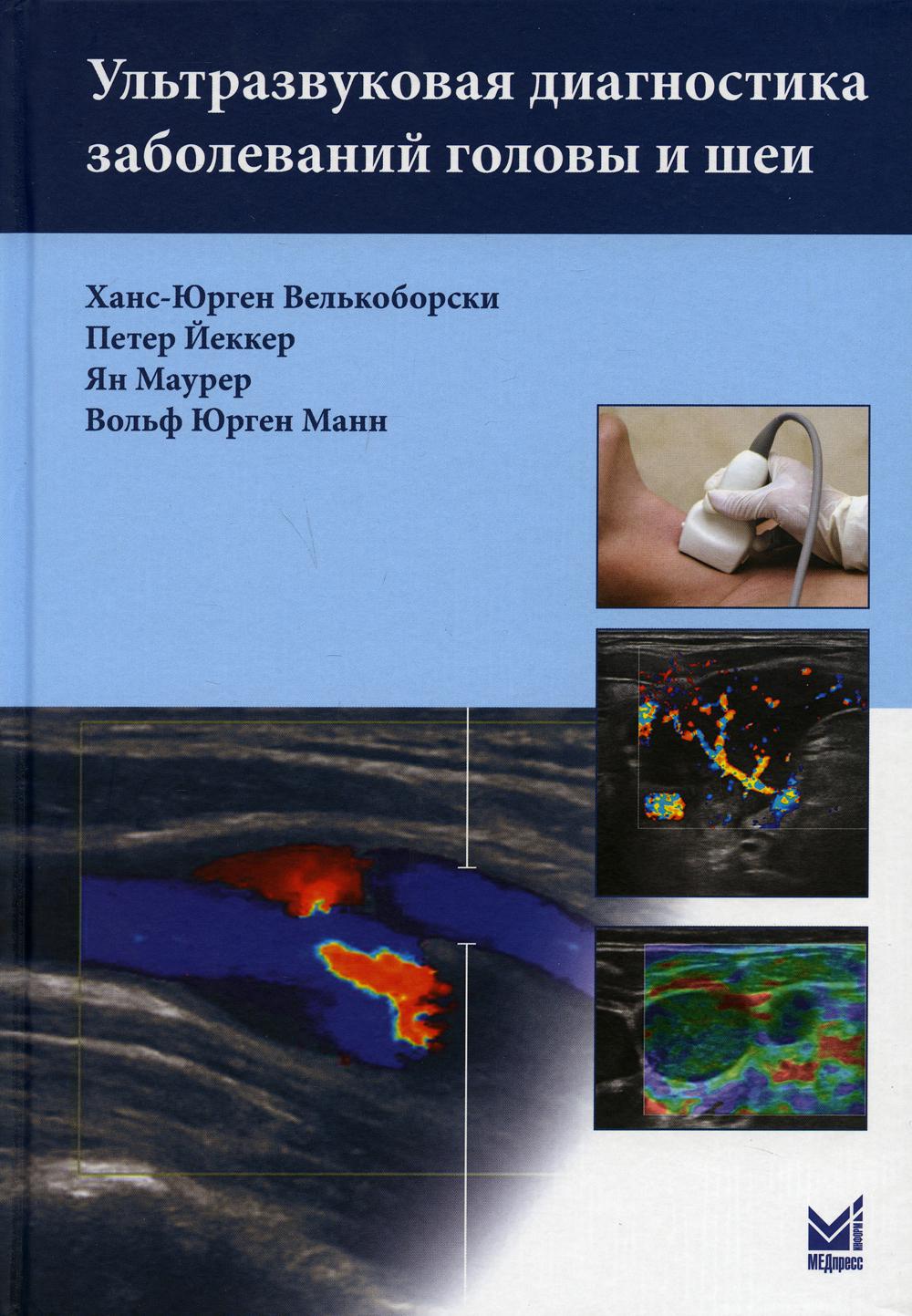 фото Книга ультразвуковая диагностика заболеваний головы и шеи. 2-е изд медпресс-информ