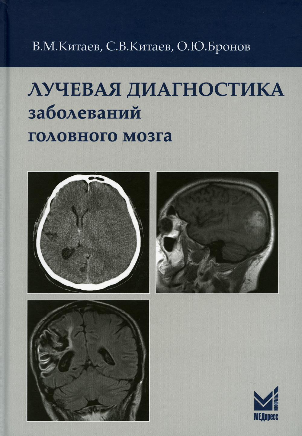 фото Книга лучевая диагностика заболеваний головного мозга. 3-е изд медпресс-информ