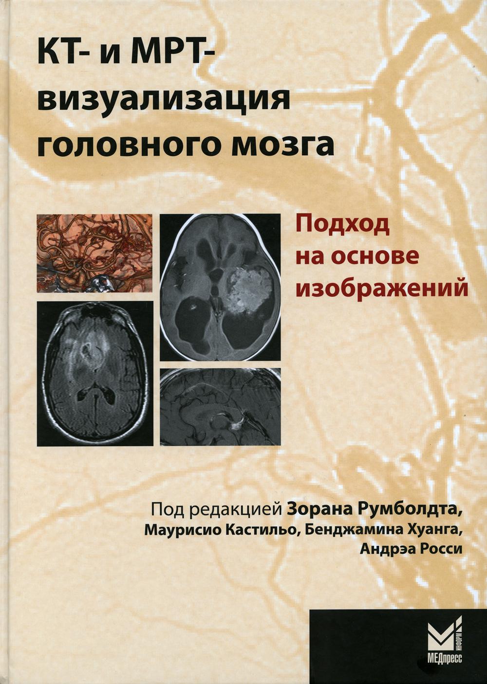 фото Книга кт- и мрт- визуализация головного мозга. подход на основе изображений. 2-е изд медпресс-информ