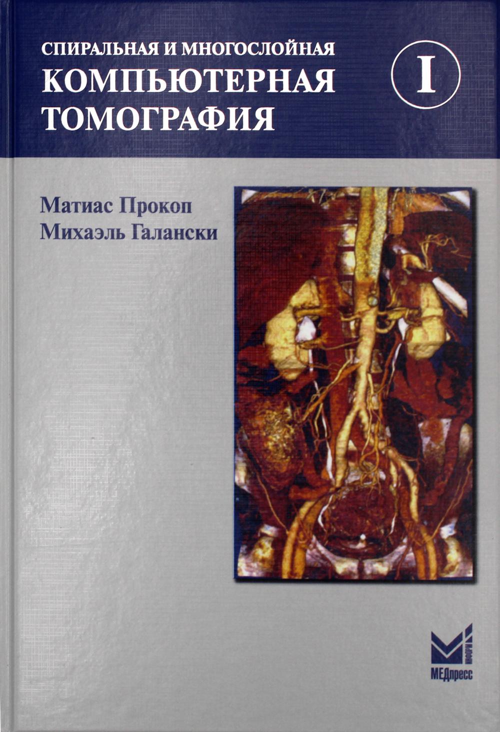 фото Книга спиральная и многослойная компьютерная томография. в 2 т. т.1: учебное пособие. 4... медпресс-информ