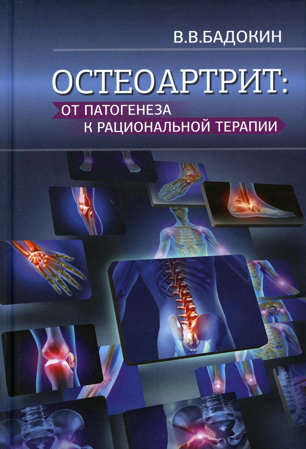 фото Книга остеоартрит: от патогенеза к рациональной терапии медпресс-информ