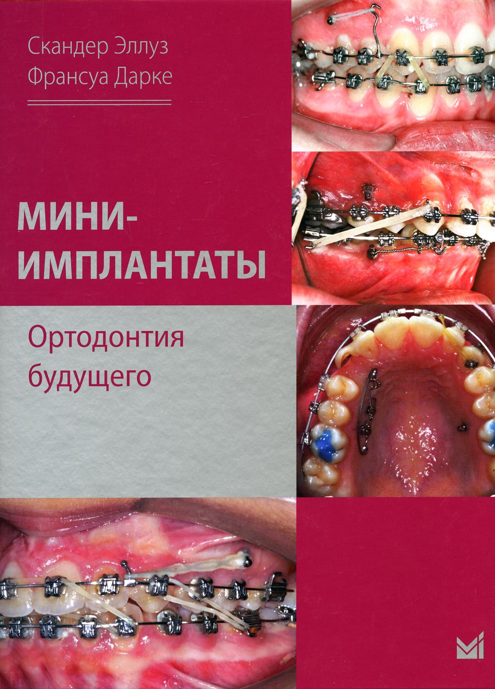 фото Книга мини-имплантаты. ортодонтия будущего медпресс-информ