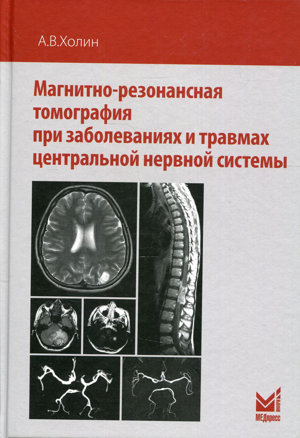 

Магнитно-резонансная томография при заболеваниях и травмах центральной нервной си...