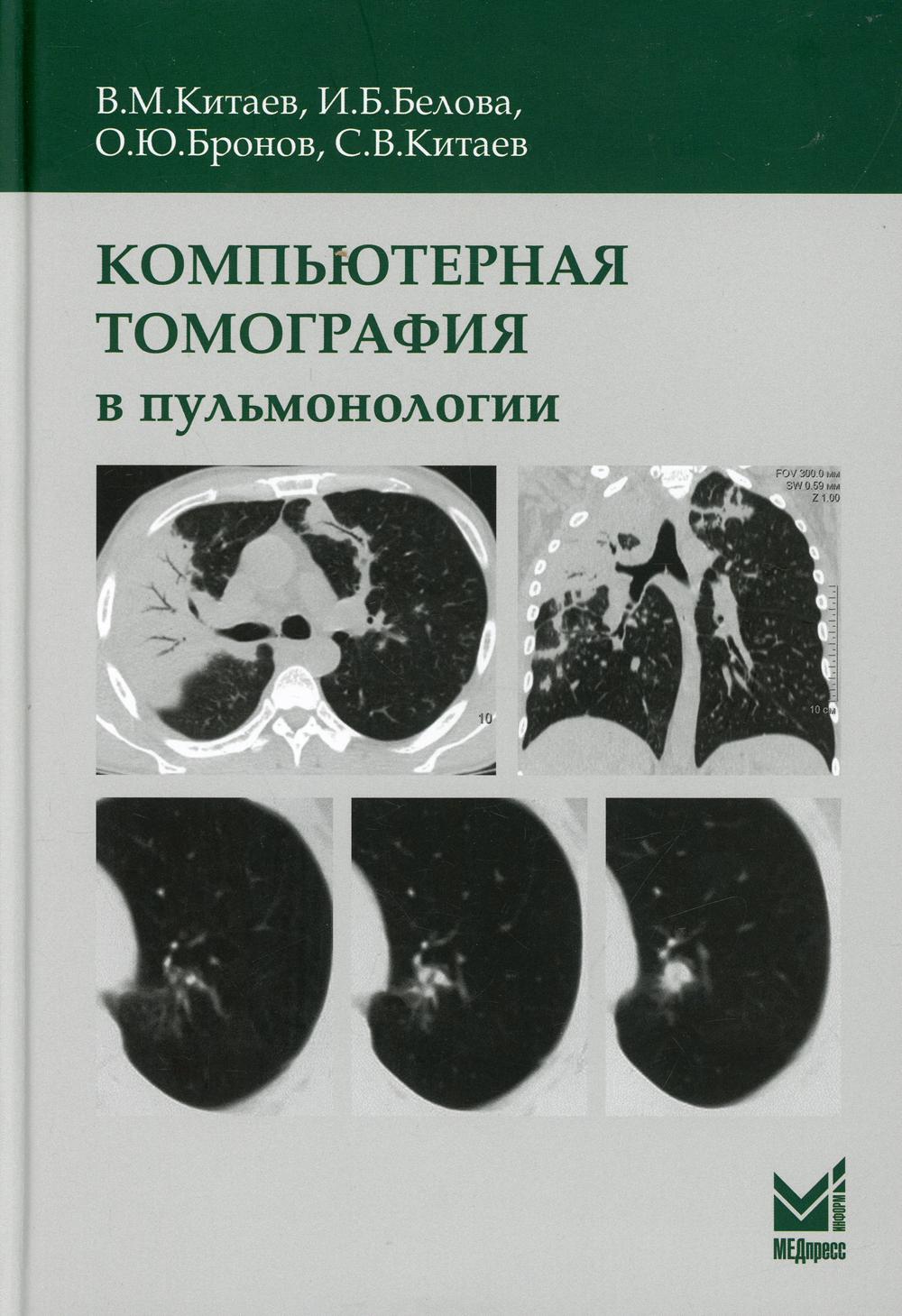 фото Книга компьютерная томография в пульмонологии медпресс-информ