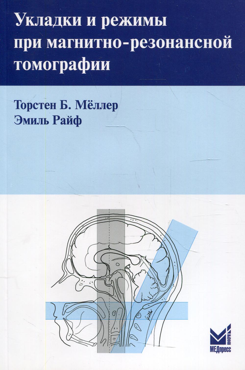 

Укладки и режимы при магнитно-резонансной томографии