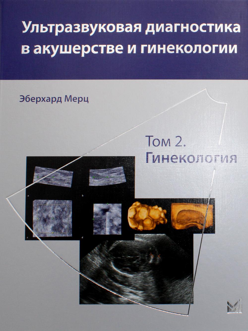 

Ультразвуковая диагностика в акушерстве и гинекологии