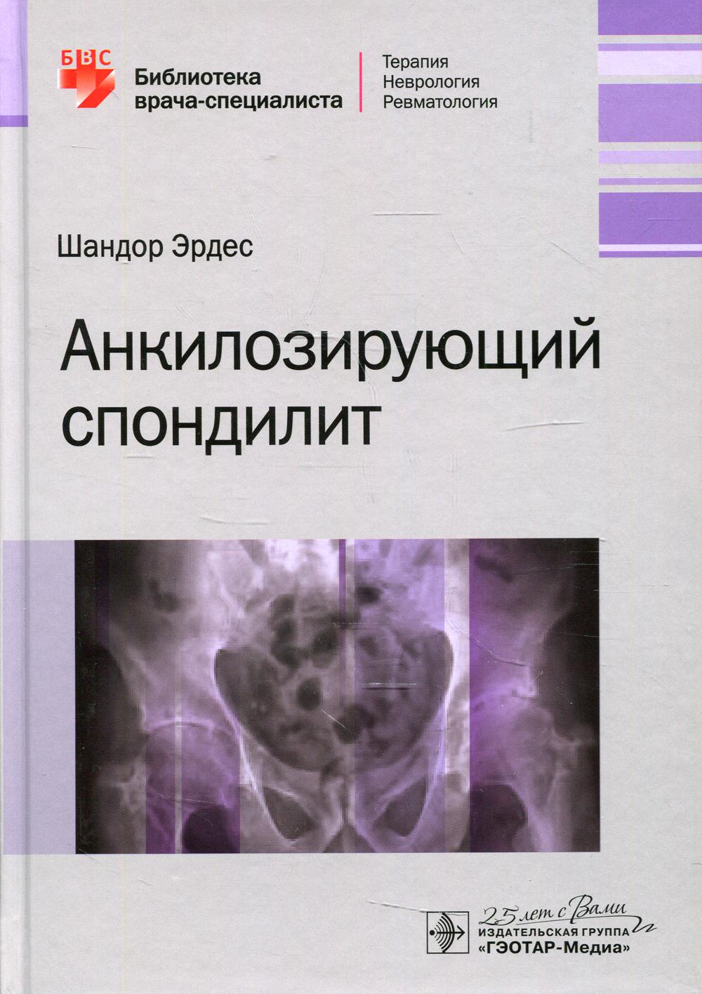 фото Книга анкилозирующий спондилит гэотар-медиа