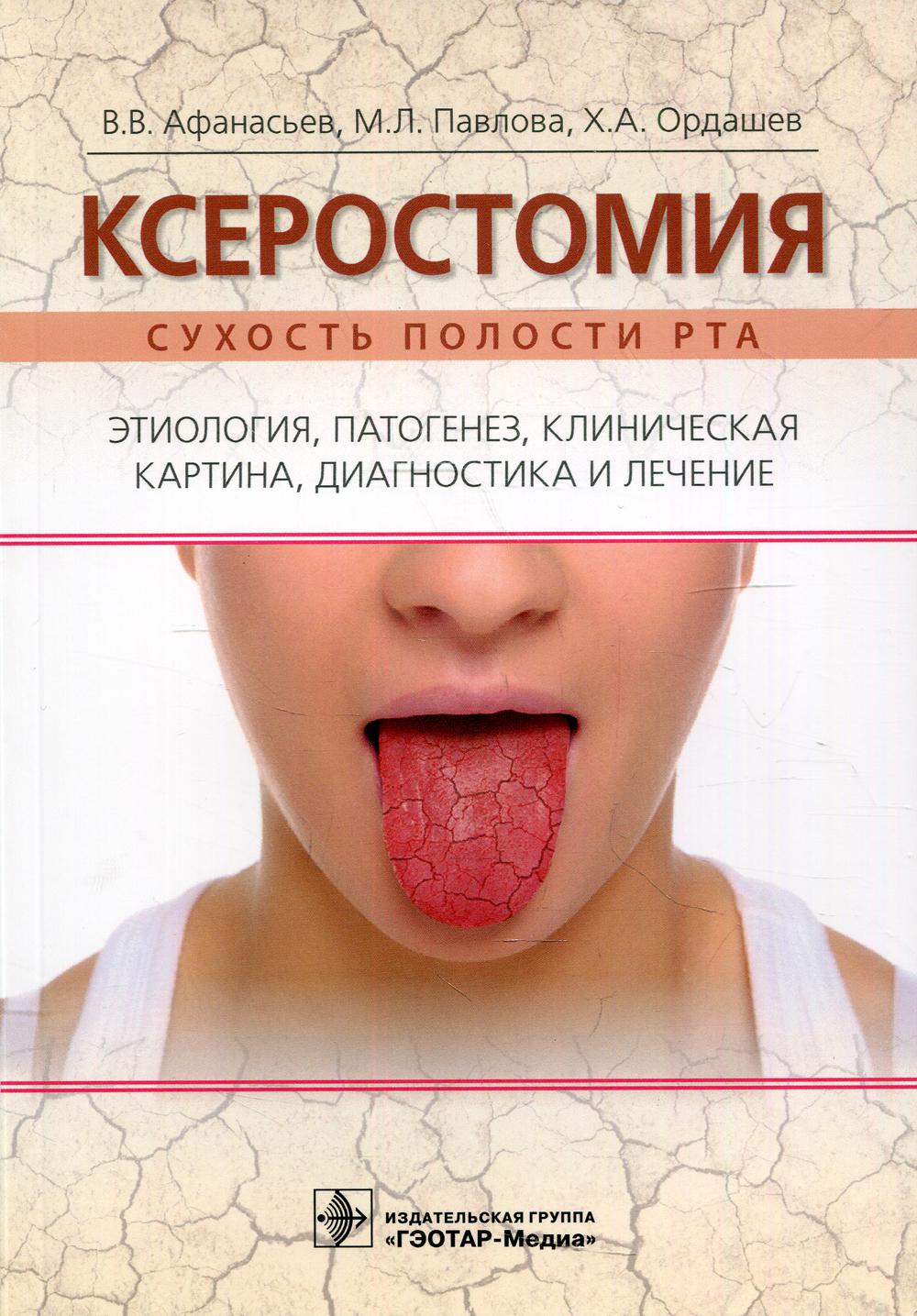 фото Книга ксеростомия (сухость полости рта) гэотар-медиа