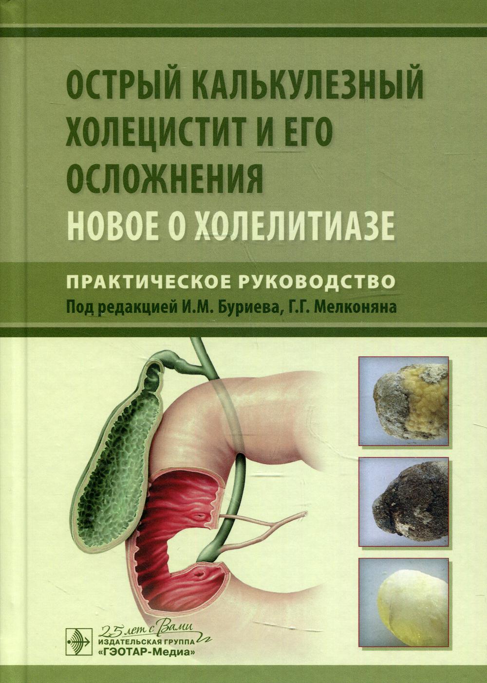 фото Книга острый калькулезный холецистит и его осложнения. новое о холелитиазе гэотар-медиа