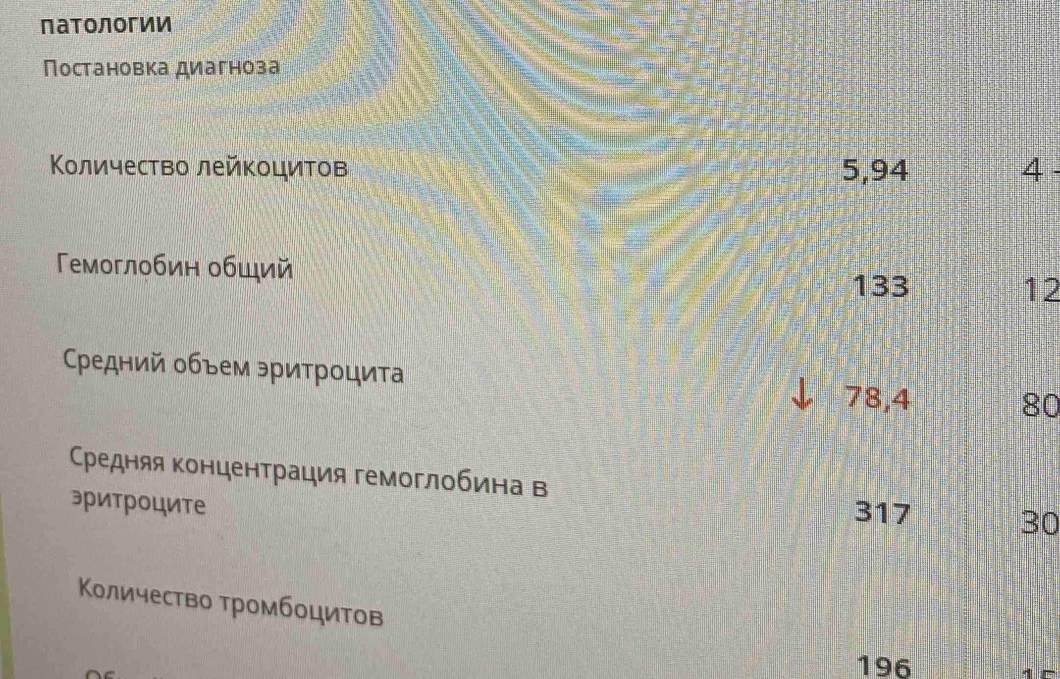 Сорбифер Дурулес таблетки 50 шт. - купить в интернет-магазинах, цены на  Мегамаркет | средства для стимуляции кроветворения 43482