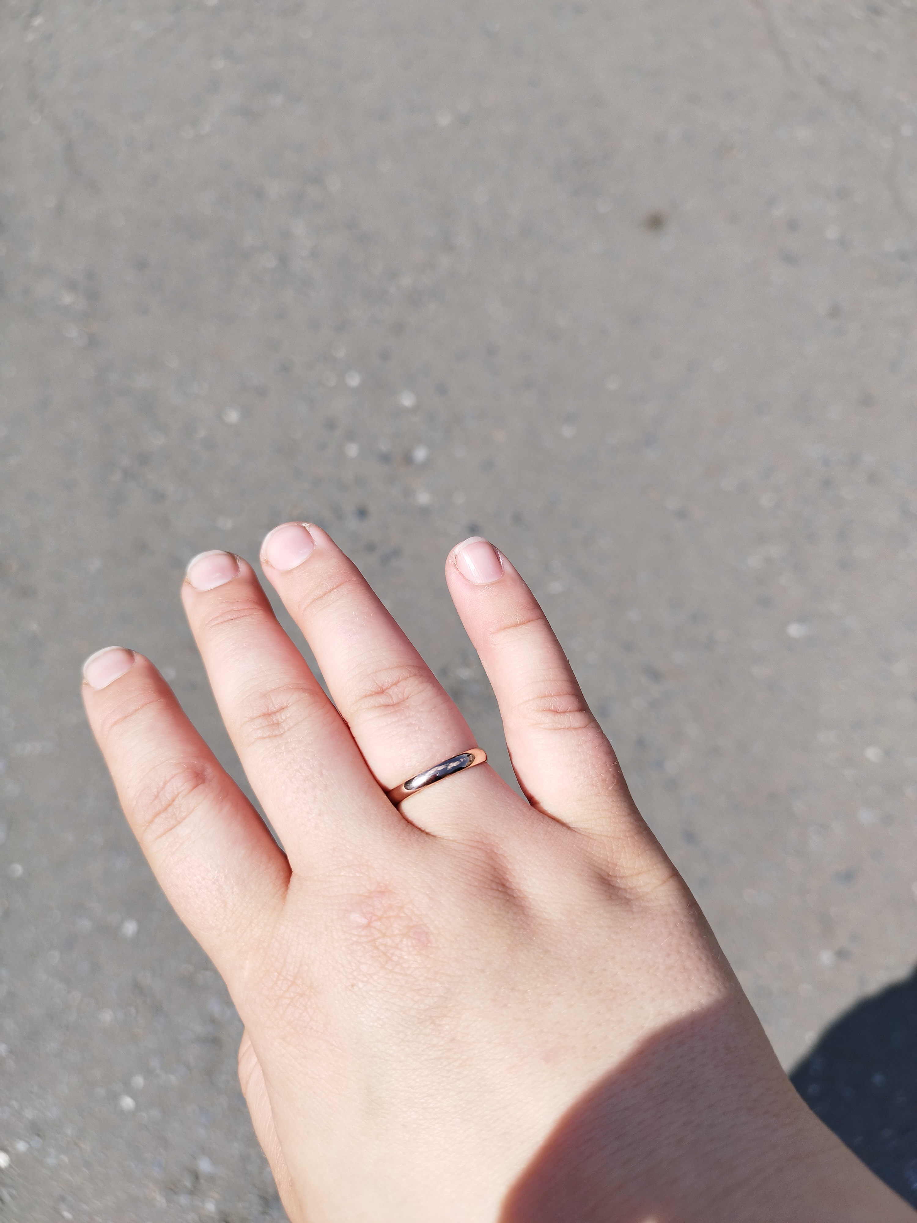 кольцо окисляется на пальце. отпечаток от кольца на пальце. чернеет палец от золота. потемневшее золотое украшение. кольцо 3 грамма.